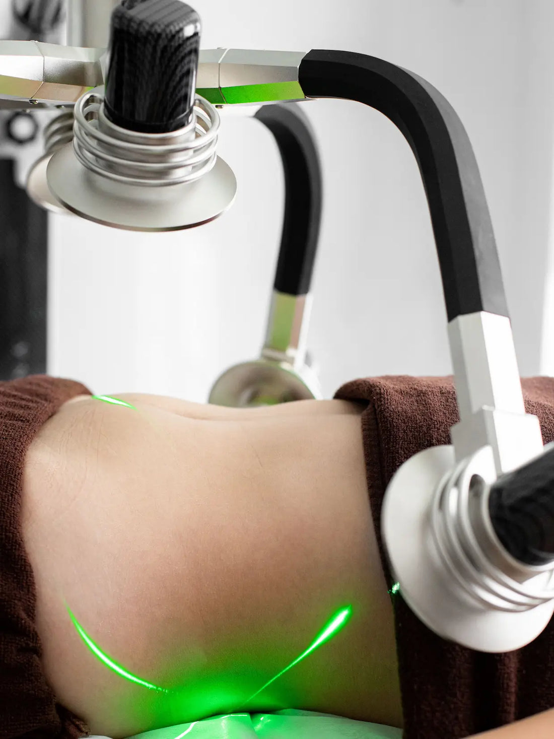 Indiba corporal: firmeza, celulitis y bienestar en un solo tratamiento