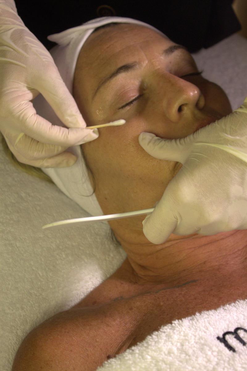 Aplicacion de un peeling facial en la cabina de Glo&Beauty Badalona